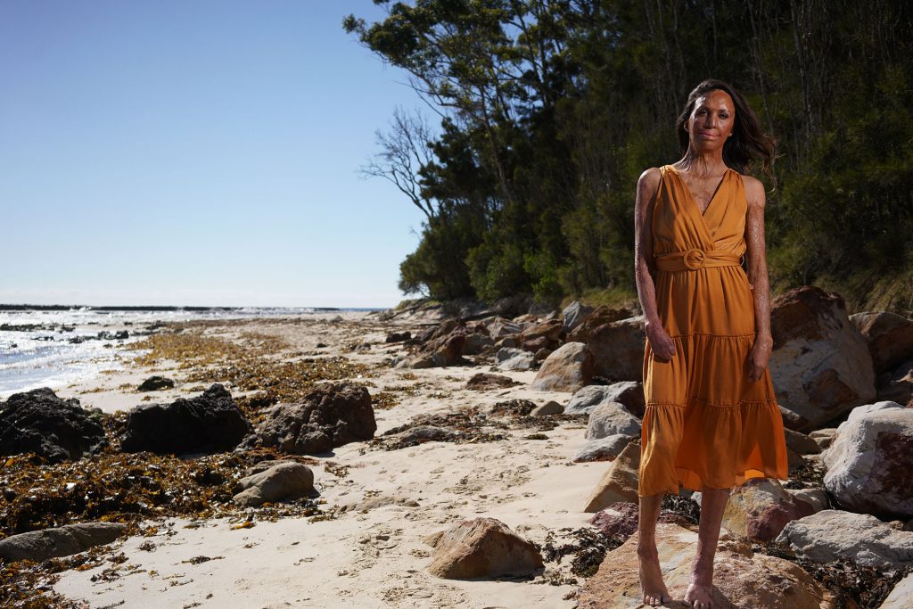Turia Pitt Mama Disrupt