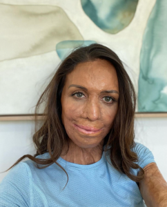 Turia Pitt Mama Disrupt